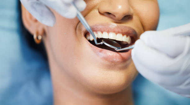 Best Emergency Denture Repair in Riverside, OH